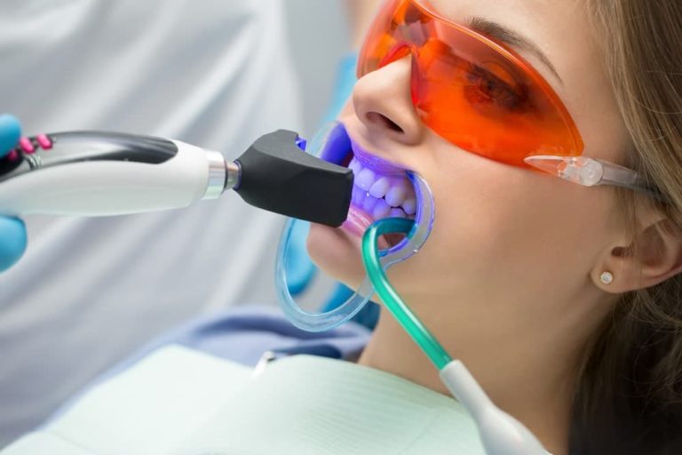5 façons de rendre les soins dentaires plus abordables